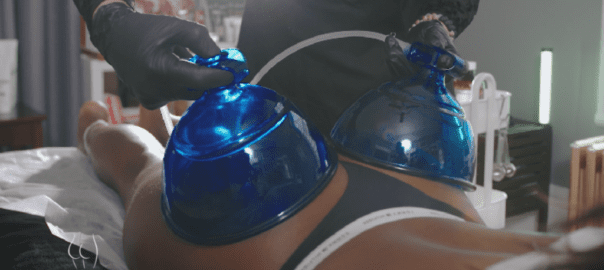 vacuum therapy training