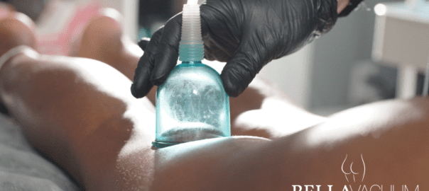 traitement Ventouse Cellulite