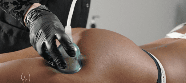 vacuothérapie cellulite
