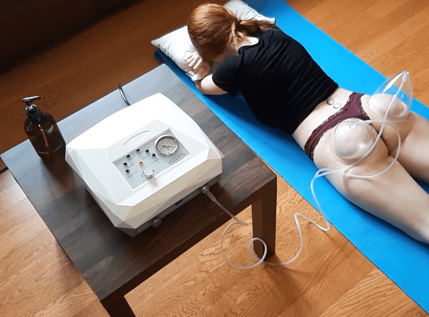 Bella Vacuum V2 - Kit Solo (traitement à la maison) – Image 2