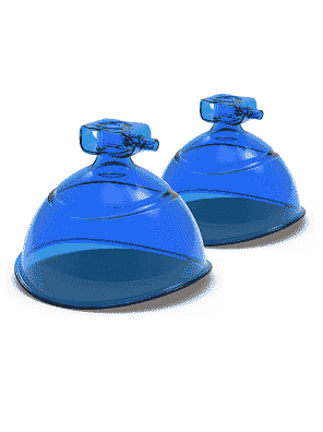 ventouse bleue lifting colombien